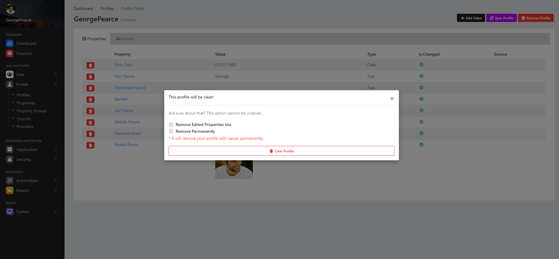 Remove Profile